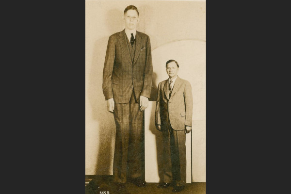 世界で一番大きな人間「ロバート・ワドロー」。その身長がなんと…